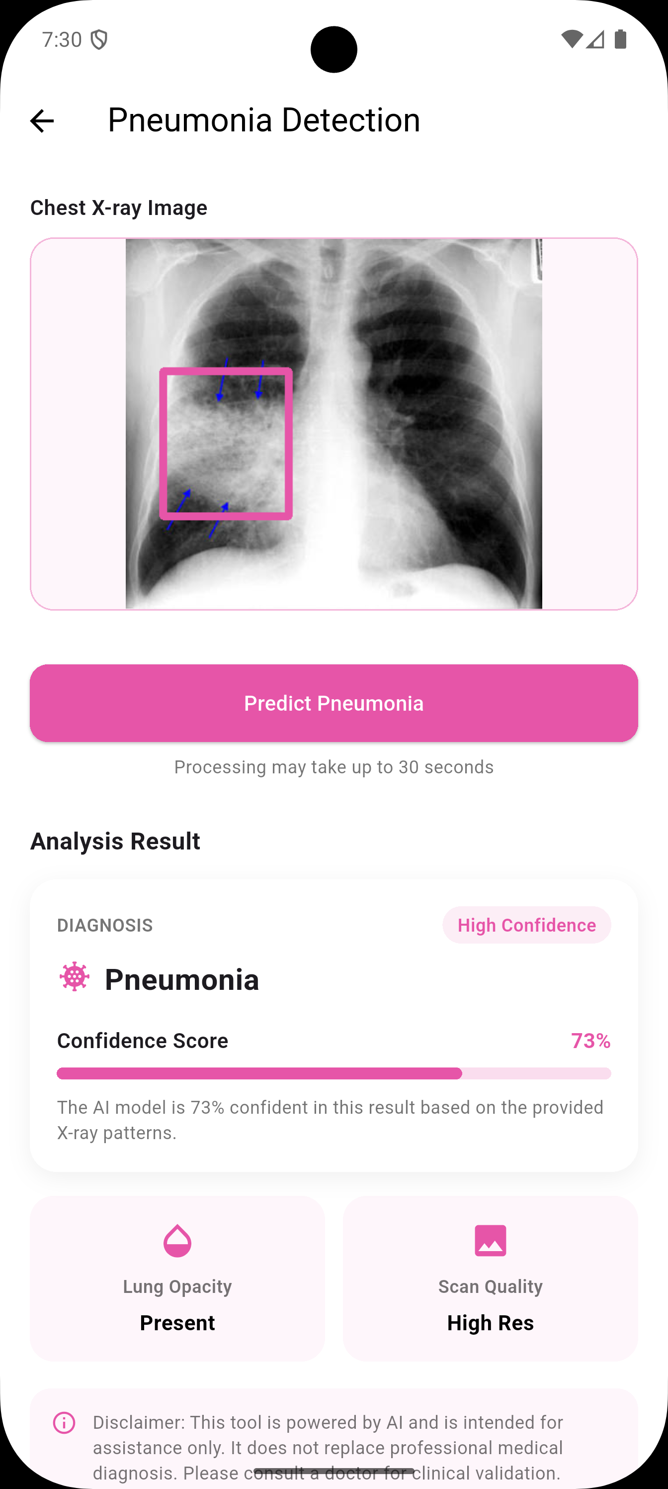 Lung disease detection screenshot 2