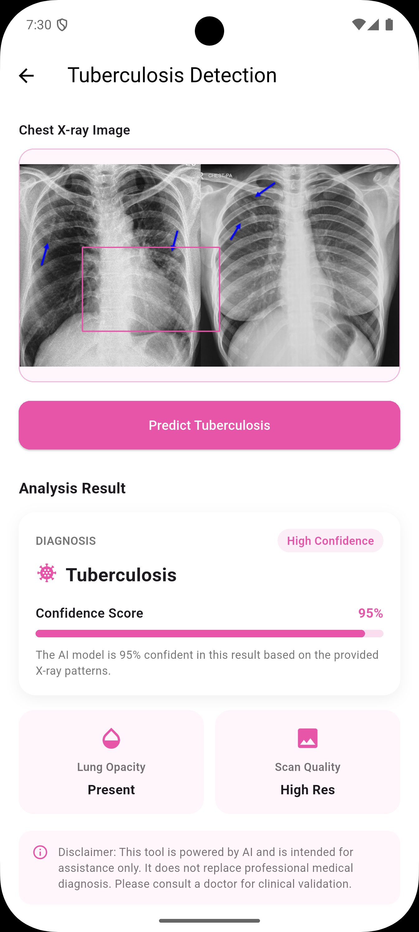 Lung disease detection screenshot 3