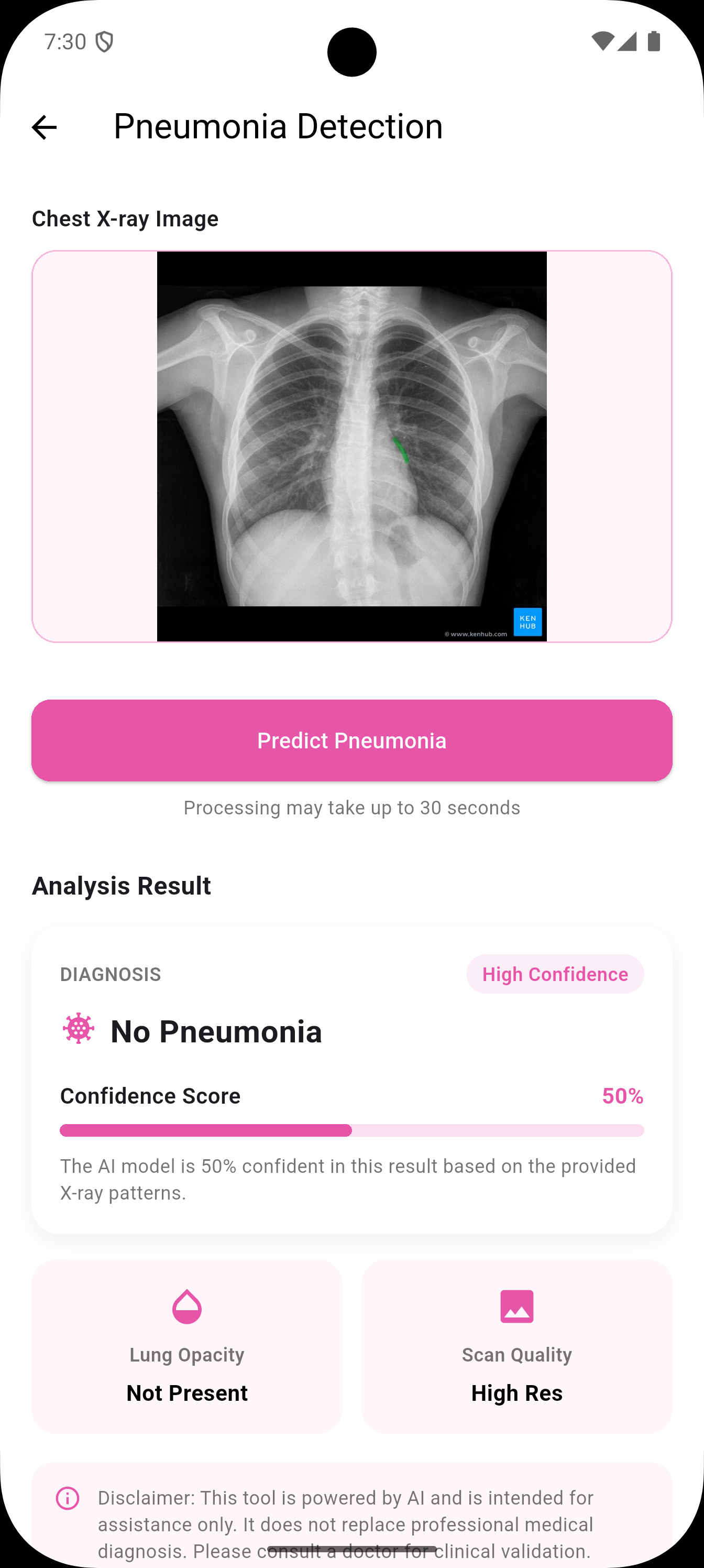 Lung disease detection screenshot 4